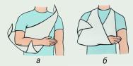 Иммобилизация верхней конечности при повреждении (вывихе) плечевого сустава с помощью косынки: а, б — этапы иммобилизации.